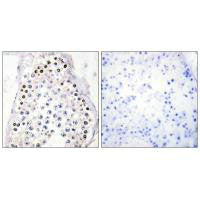 Immunohistochemistry analysis of paraffin-embedded human testis tissue, using HOXA1/B1/D1 antibody.