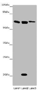 Western blot All lanes: SRF antibody at 12 ug/ml Lane 1: Mouse heart tissue Lane 2: NIH/3T3 whole cell lysate Lane 3: MCF-7 whole cell lysate Secondary Goat polyclonal to rabbit IgG at 1/10000 dilution Predicted band size: 52 kDa Observed band siz...