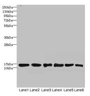 Western blot All lanes: SOD1 antibody at 6µg/ml Lane 1: Mouse liver tissue Lane 2: Mouse brain tissue Lane 3: Hela whole cell lysate Lane 4: MCF-7 whole cell lysate Lane 5: A549 whole cell lysate Lane 6: HepG2 whole cell lysate Secondary Goat poly...