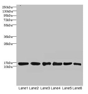 Western blot All lanes: SOD1 antibody at 6µg/ml Lane 1: Mouse liver tissue Lane 2: Mouse brain tissue Lane 3: Hela whole cell lysate Lane 4: MCF-7 whole cell lysate Lane 5: A549 whole cell lysate Lane 6: HepG2 whole cell lysate Secondary Goat poly...