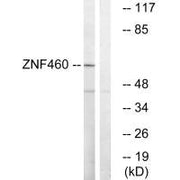 Western blot analysis of extracts from LOVO cells, using ZNF460 antibody.