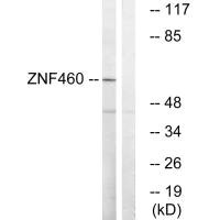 Western blot analysis of extracts from LOVO cells, using ZNF460 antibody.