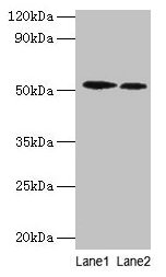 Western blot All lanes: RPS6KB2 antibody at 2µg/ml Lane 1: EC109 whole cell lysate Lane 2: 293T whole cell lysate Secondary Goat polyclonal to rabbit IgG at 1/15000 dilution Predicted band size: 54, 17 kDa Observed band size: 54 kDa