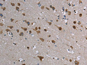 The image is immunohistochemistry of paraffin-embedded Human brain tissue using CSB-PA029397(CASP8AP2 Antibody) at dilution 1/20. (Original magnification: ×200)