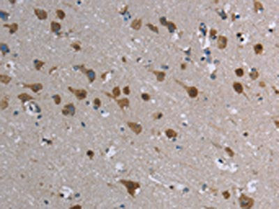 The image is immunohistochemistry of paraffin-embedded Human brain tissue using CSB-PA029397(CASP8AP2 Antibody) at dilution 1/20. (Original magnification: ×200)