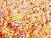 IHC image of CSB-PA02939A0Rb diluted at 1:100 and staining in paraffin-embedded human adrenal gland tissue performed on a Leica BondTM system. After dewaxing and hydration, antigen retrieval was mediated by high pressure in a citrate buffer (pH 6....