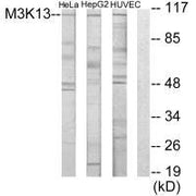 Western blot analysis of extracts from HeLa cells, HUVEC cells and HepG2 cells, using M3K13 antibody.