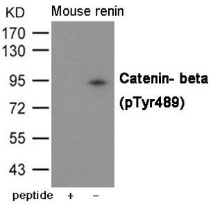Western blot analysis of extracts from Mouse renin using Catenin- beta (Phospho-Tyr489) Antibody.The lane on the left is treated with the antigen-specific peptide.