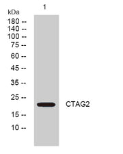 Western blot analysis of lysates from DU145 cells, primary antibody was diluted at 1:1000, 4°over night