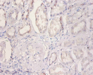 Immunohistochemistry of paraffin-embedded human kidney tissue using CSB-PA02989A0Rb at dilution of 1:100