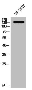 Western Blot analysis of SH-SY5Y cells using PDGFR-α Polyclonal Antibody