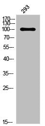 Western Blot analysis of 293 cells using Phospho-PR (S294) Polyclonal Antibody