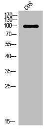 Western Blot analysis of Jurkat cells using PR Polyclonal Antibody