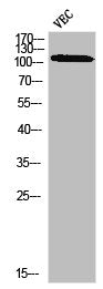 Western blot analysis of VEC using p-cPLA2 (S505) antibody.