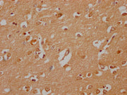 IHC image of CSB-PA030070HA01HU diluted at 1:200 and staining in paraffin-embedded human brain tissue performed on a Leica BondTM system. After dewaxing and hydration, antigen retrieval was mediated by high pressure in a citrate buffer (pH 6.0). S...