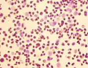 Immunohistochemistry of paraffin-embedded LO2 cells using CSB-PA03007A0Rb at dilution of 1:50