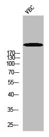 Western blot analysis of VEC using p-Rpb1 (S1619) antibody.