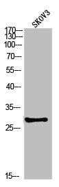 Western blot analysis of SKOV3 using p-PP2A-Cα (Y307) antibody.