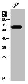 Western Blot analysis of Colo cells using ZIP4 Polyclonal Antibody