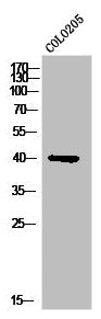 Western Blot analysis of COLO205 cells using PKAγ cat Polyclonal Antibody