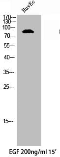 Western Blot analysis of HuvEc cells using Phospho-Axl (Y691) Polyclonal Antibody