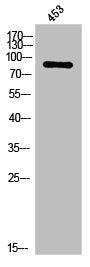 Western Blot analysis of 453 cells using PKC ε Polyclonal Antibody