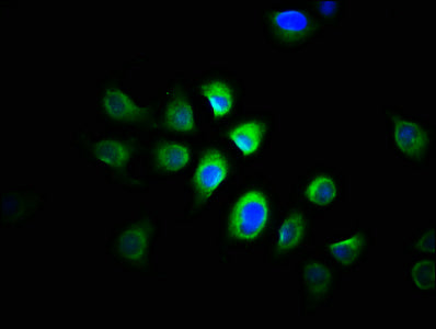Immunofluorescence staining of A549 cells with CSB-PA03025A0Rb at 1:166, counter-stained with DAPI. The cells were fixed in 4% formaldehyde, permeabilized using 0.2% Triton X-100 and blocked in 10% normal Goat Serum. The cells were then incubated...
