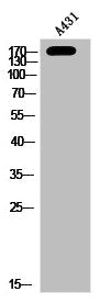 Western Blot analysis of A431 cells using Phospho-PKD1 (S910) Polyclonal Antibody
