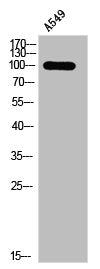 Western Blot analysis of A549 cells using Phospho-PKD1/2/3 (S738/S742) Polyclonal Antibody