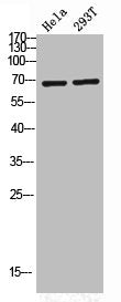 Western Blot analysis of HELA 293T cells using Phospho-PKC ζ (T560) Polyclonal Antibody