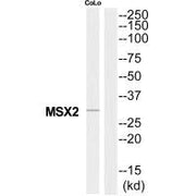 Western blot analysis of extracts from COLO205 cells, using MSX2 antibody.