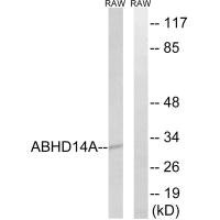 Western blot analysis of extracts from RAW264.7 cells, using ABHD14A antibody.