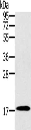 Gel: 10%SDS-PAGE, Lysate: 40 ug, Lane: Mouse heart tissue, Primary antibody: CSB-PA030538(RNF122 Antibody) at dilution 1/300, Secondary antibody: Goat anti rabbit IgG at 1/8000 dilution, Exposure time: 1 minute