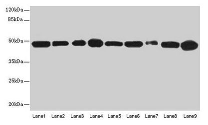 Western blot All lanes: GOT2 antibody at 3µg/ml Lane 1: A431 whole cell lysate Lane 2: HepG2 whole cell lysate Lane 3: Mouse muscle tissue Lane 4: Mouse spleen tissue Lane 5: MCF-7 whole cell lysate Lane 6: Hela whole cell lysate Lane 7: LO2 whole...