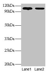 Western blot All lanes: EXTL3 antibody at 2µg/ml Lane 1: EC109 whole cell lysate Lane 2: 293T whole cell lysate Secondary Goat polyclonal to rabbit IgG at 1/15000 dilution Predicted bane side: 105 kDa Observed band side: 105 kDa