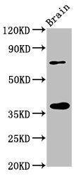 Western Blot Positive WB detected in: Rat brain tissue All lanes: EIF3I antibody at 3.2µg/ml Secondary Goat polyclonal to rabbit IgG at 1/50000 dilution Predicted band size: 37 kDa Observed band size: 37 kDa