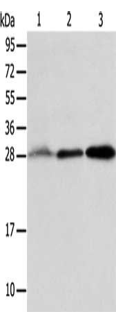 Gel: 12%SDS-PAGE, Lysate: 40 ug, Lane 1-3: Human fetal liver tissue, Human seminoma tissue, RAW264.7 cells, Primary antibody: CSB-PA031205(ALKBH2 Antibody) at dilution 1/800, Secondary antibody: Goat anti rabbit IgG at 1/8000 dilution, Exposure ti...
