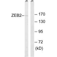 Western blot analysis of extracts from HepG2 cells, using ZEB2 antibody.
