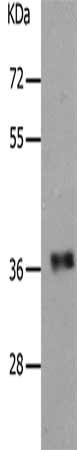 Gel: 10%SDS-PAGE, Lysate: 40 ug, Lane: Human fetal muscle tissue, Primary antibody: CSB-PA031578(PARD6A Antibody) at dilution 1/650, Secondary antibody: Goat anti rabbit IgG at 1/8000 dilution, Exposure time: 30 seconds