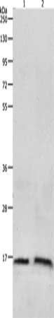 Gel: 10+12%SDS-PAGE, Lysate: 40 ug, Lane 1-2: 293T cells, Human fetal brain tissue, Primary antibody: CSB-PA031640(LHB Antibody) at dilution 1/250, Secondary antibody: Goat anti rabbit IgG at 1/8000 dilution, Exposure time: 5 minutes