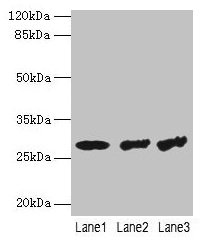 Western blot All lanes: TBCB antibody at 4µg/ml Lane 1: Hela whole cell lysate Lane 2: A549 whole cell lysate Lane 3: Jurkat whole cell lysate Secondary Goat polyclonal to rabbit IgG at 1/10000 dilution Predicted band size: 28, 22 kDa Observed ban...