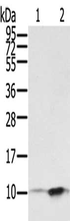 Gel: 12%SDS-PAGE, Lysate: 40 ug, Lane 1-2: A431 cells, hela cells, Primary antibody: CSB-PA031961(S100P Antibody) at dilution 1/650, Secondary antibody: Goat anti rabbit IgG at 1/8000 dilution, Exposure time: 30 seconds