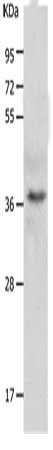 Gel: 10+12%SDS-PAGE, Lysate: 40 ug, Lane: A549 cells, Primary antibody: CSB-PA031979(C1QTNF5 Antibody) at dilution 1/300, Secondary antibody: Donkey anti Guinea pig IgG at 1/8000 dilution, Exposure time: 5 seconds