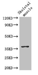 Western Blot Positive WB detected in: Mouse skeletal muscle tissue All lanes: DNAJB6 antibody at 2.8ug/ml Secondary Goat polyclonal to rabbit IgG at 1/50000 dilution Predicted band size: 37, 27, 36, 31 kDa Observed band size: 37 kDa