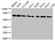 Western Blot Positive WB detected in: HEK293 whole cell lysate, A549 whole cell lysate, Colo320 whole cell lysate, Hela whole cell lysate, HepG2 whole cell lysate, Mouse brain tissue, Rat brain tissue, Rat lung tissue All lanes: HSPA8 antibody at...