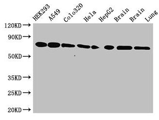 Western Blot Positive WB detected in: HEK293 whole cell lysate, A549 whole cell lysate, Colo320 whole cell lysate, Hela whole cell lysate, HepG2 whole cell lysate, Mouse brain tissue, Rat brain tissue, Rat lung tissue All lanes: HSPA8 antibody at...