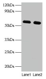 Western blot All lanes: PHGDH antibody at 2µg/ml Lane 1: EC109 whole cell lysate Lane 2: 293T whole cell lysate Secondary Goat polyclonal to rabbit IgG at 1/15000 dilution Predicted band size: 57 kDa Observed band size: 57 kDa