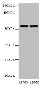 Western blot All lanes: PHGDH antibody at 2µg/ml Lane 1: EC109 whole cell lysate Lane 2: 293T whole cell lysate Secondary Goat polyclonal to rabbit IgG at 1/10000 dilution Predicted band size: 57 kDa Observed band size: 57 kDa