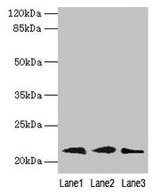 Western blot All lanes: RAP1B antibody at 0.7µg/ml Lane 1: Mouse brain tissue Lane 2: A549 whole cell lysate Lane 3: A431 whole cell lysate Secondary Goat polyclonal to rabbit IgG at 1/10000 dilution Predicted band size: 21, 16, 19, 17 kDa Observe...