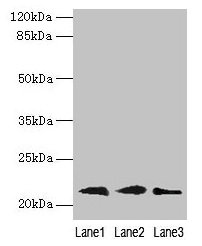 Western blot All lanes: RAP1B antibody at 0.7µg/ml Lane 1: Mouse brain tissue Lane 2: A549 whole cell lysate Lane 3: A431 whole cell lysate Secondary Goat polyclonal to rabbit IgG at 1/10000 dilution Predicted band size: 21, 16, 19, 17 kDa Observe...